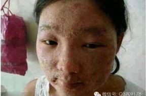 毒素脸照片,照片背后的健康警示